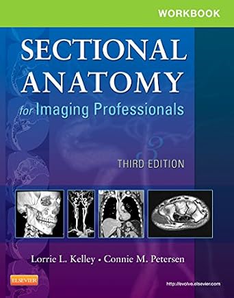 خرید و دانلود نسخه کامل کتاب Workbook for Sectional Anatomy for Imaging Professionals – E-Book_6a70391d52fc4.jpeg خرید و دانلود نسخه کامل کتاب Workbook for Sectional Anatomy for Imaging Professionals – E-Book