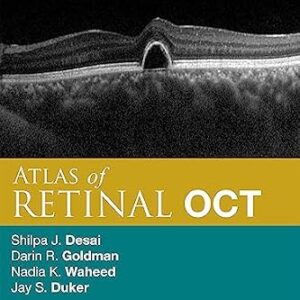 خرید و دانلود نسخه کامل کتاب Atlas of Retinal OCT E-Book: Optical Coherence Tomography