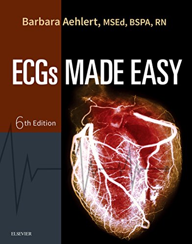 خرید و دانلود نسخه کامل کتاب ECGs Made Easy – E-Book 6th Edition_6a6f336ee6f2f.jpeg خرید و دانلود نسخه کامل کتاب ECGs Made Easy – E-Book 6th Edition