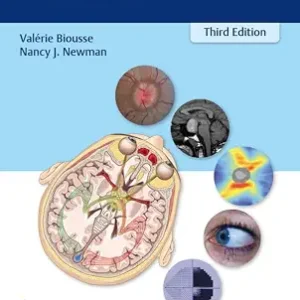 خرید و دانلود نسخه کامل کتاب Neuro-Ophthalmology Illustrated