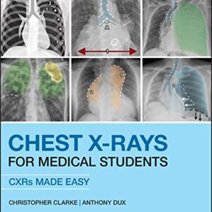 خرید و دانلود نسخه کامل کتاب Chest X-Rays for Medical Students: CXRs Made Easy 2nd Edition
