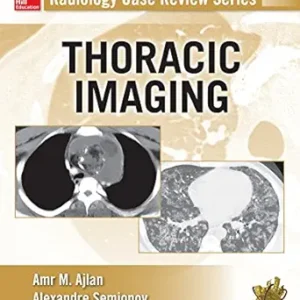 خرید و دانلود نسخه کامل کتاب Radiology Case Review Series: Thoracic Imaging