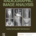 خرید و دانلود نسخه کامل کتاب Radiographic Image Analysis – E-Book