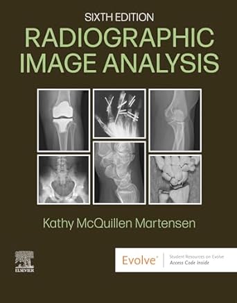 خرید و دانلود نسخه کامل کتاب Radiographic Image Analysis – E-Book_6a6e695d12d47.jpeg خرید و دانلود نسخه کامل کتاب Radiographic Image Analysis – E-Book