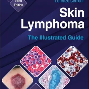 خرید و دانلود نسخه کامل کتاب Skin Lymphoma: The Illustrated Guide